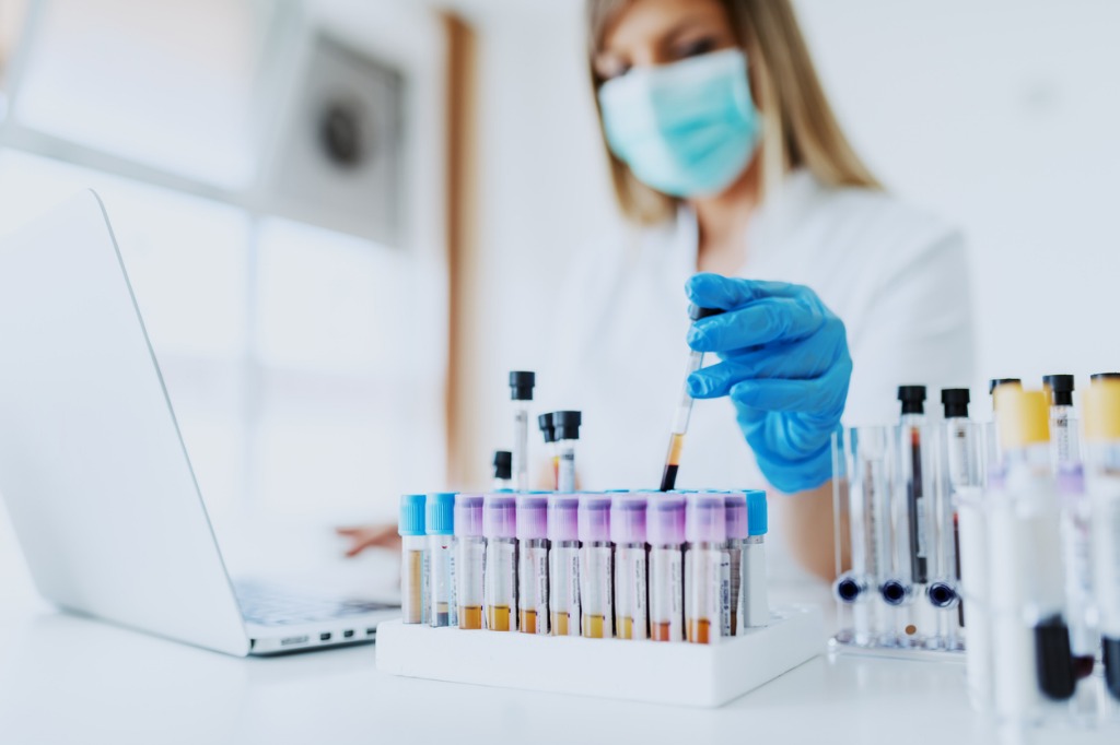 Medical Lab Factoring Case Study